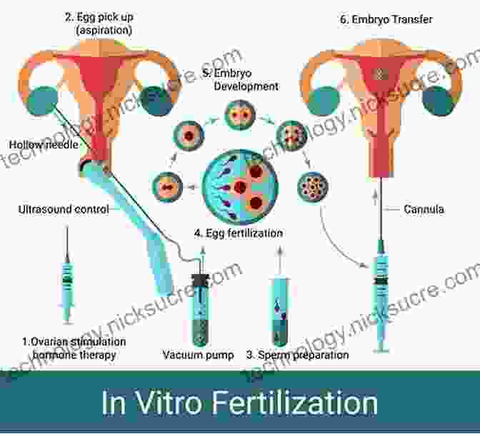 Photograph Of A Couple Undergoing In Vitro Fertilization (IVF) The Palgrave Handbook Of Infertility In History: Approaches Contexts And Perspectives